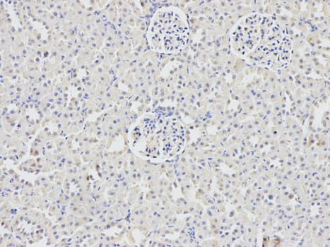DDX5 Antibody