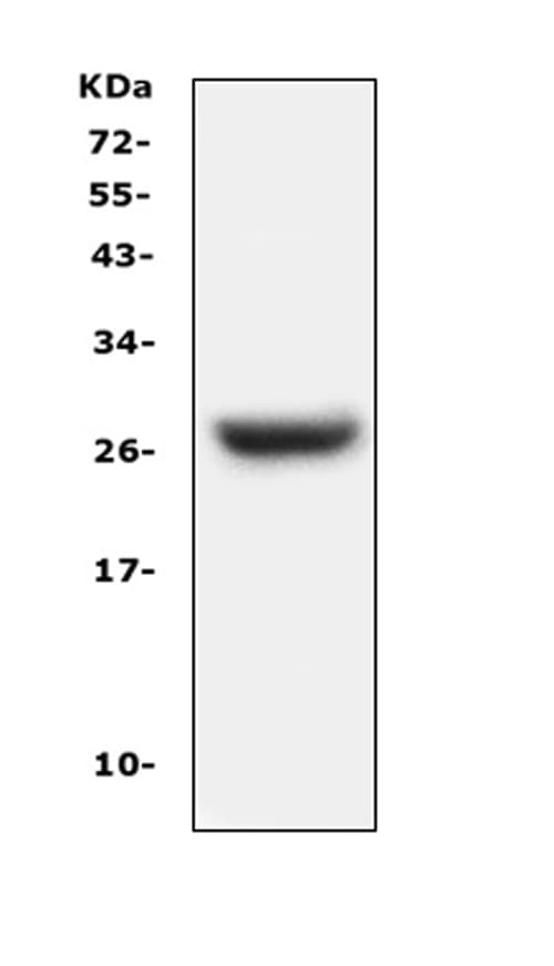 CFD / Factor D / Adipsin Antibody