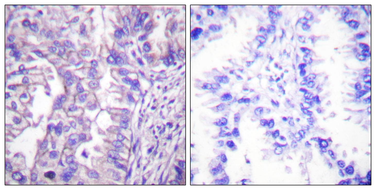 Polyclonal Rabbit anti-Human GAD1 + GAD2 Antibody (IHC, WB)