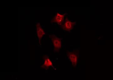 TH / Tyrosine Hydroxylase Antibody