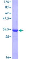 Human ATOX1 Protein (Recombinant GST, N-terminus)