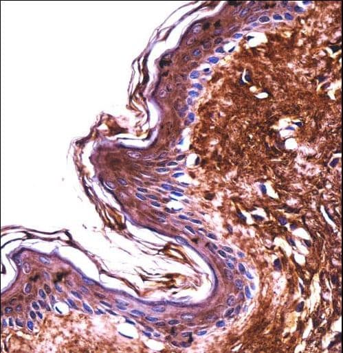 Polyclonal Rabbit anti-Human PPT2 Antibody (aa183-212, IHC, WB)