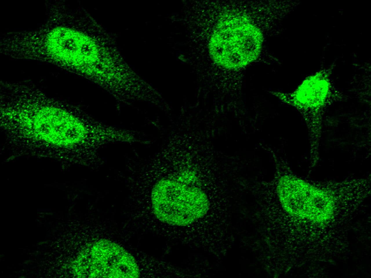 Polyclonal Rabbit anti-Human ER Alpha / Estrogen Receptor Antibody (Preservative Free, IF, WB)