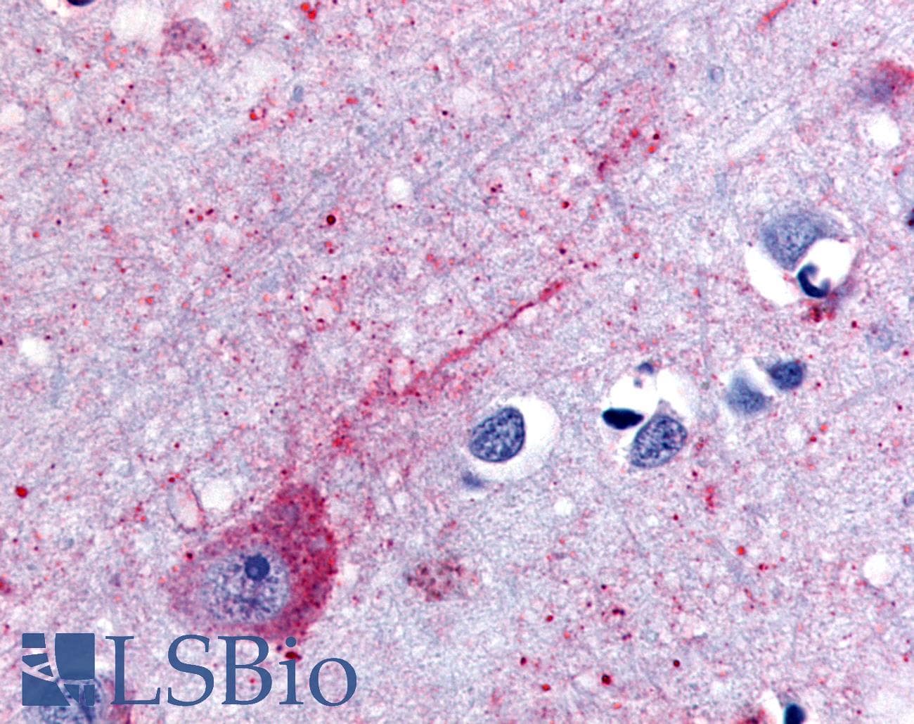 IHC-plus™ Polyclonal Rabbit anti-Human P2RY14 / GPR105 Antibody (Extracellular Domain, IHC)
