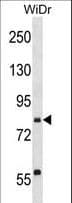 SEC23B Antibody (aa655-684)