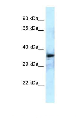 Polyclonal Rabbit anti-Human DEPTOR / DEPDC6 Antibody (aa133-182, WB)