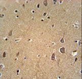 Polyclonal Rabbit anti-Mouse EPHA6 / EPH Receptor A6 Antibody (aa1006-1035, IHC, WB)