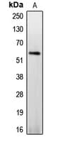 Polyclonal Rabbit anti-Human CASP8 / Caspase 8 Antibody (phospho-Ser347, IHC, WB)