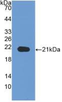 NRP1 / Neuropilin 1 Antibody (aa646-814)