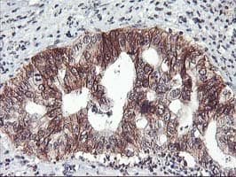 ZFP36 / Tristetraprolin Antibody (clone OTI1A2, Carrier-free)
