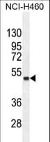 FNDC8 Antibody (aa204-232)