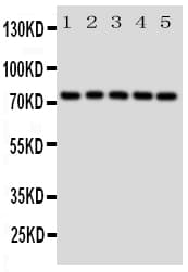 Polyclonal Rabbit anti-Human HSPA9 / Mortalin / GRP75 Antibody (aa591-609, IHC, WB)