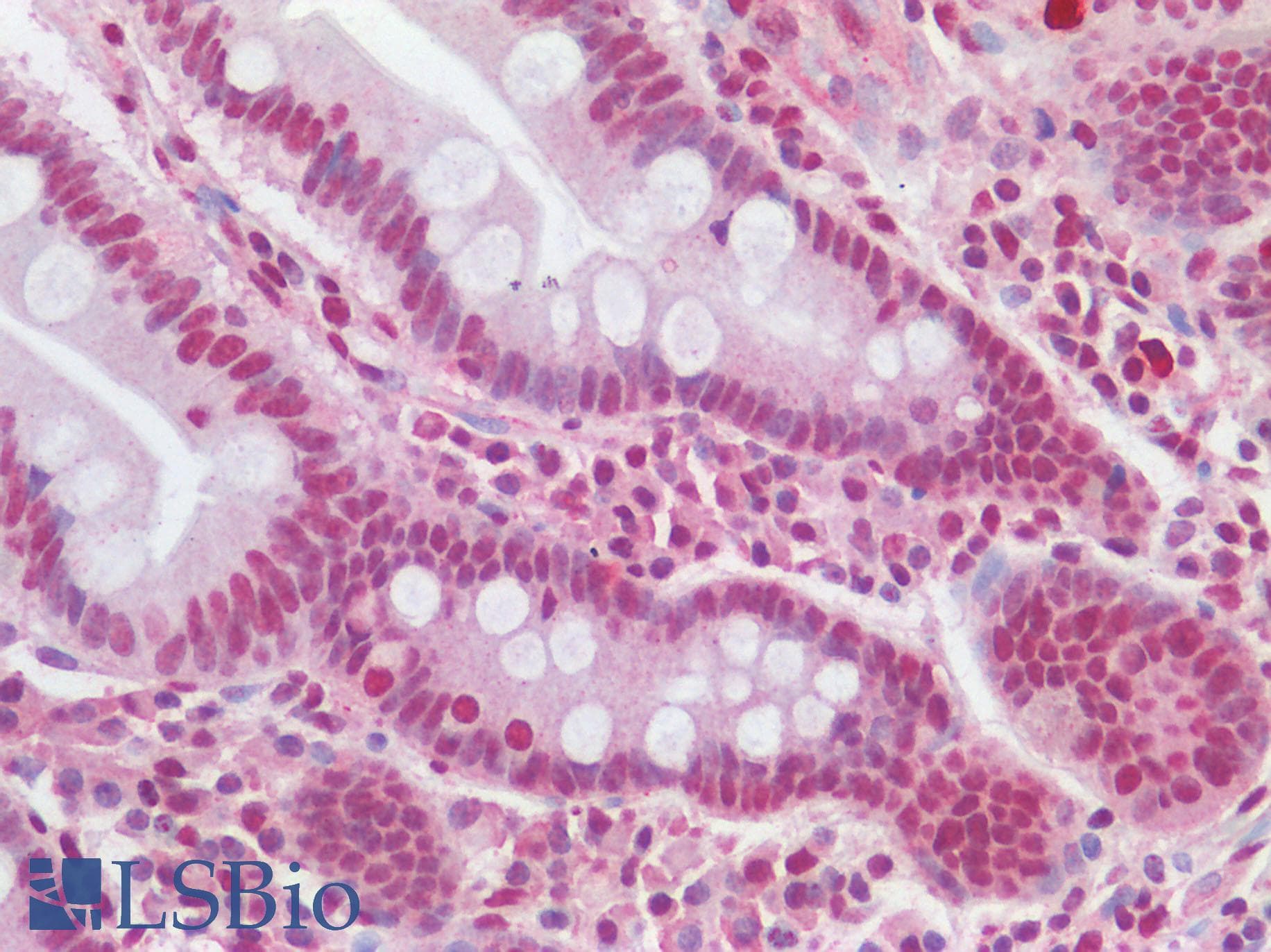 IHC-plus™ SNAI1 / SNAIL-1 Antibody (N-Terminus)