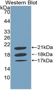 F8 / FVIII / Factor VIII Antibody (aa2191-2337)