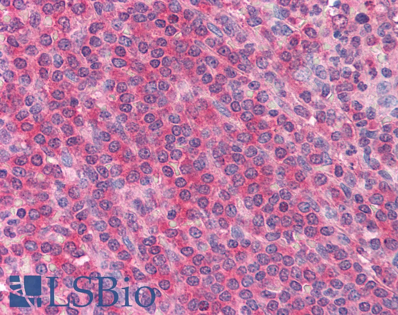 IHC-plus™ IL1A / IL-1 Alpha Antibody (clone 3A6F11)