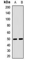Polyclonal Rabbit anti-Human GABPB2 Antibody (WB)