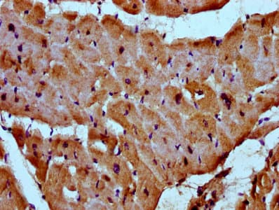 MYOZ2 / CS-1 Antibody