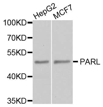 Polyclonal Rabbit anti-Human PARL / PSARL Antibody (WB)