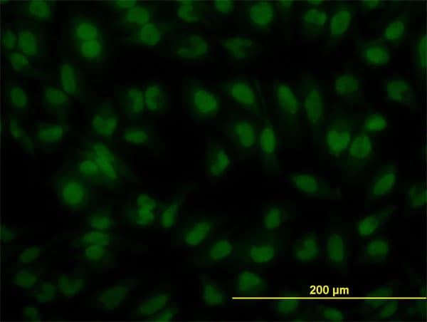 IRF2 Antibody (clone 3B5)