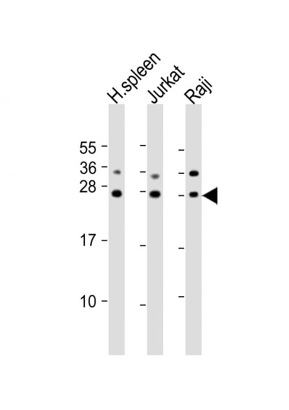 GZMH / Granzyme H Antibody (aa19-52)