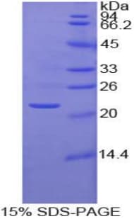Human MMP1 Protein (Recombinant His)