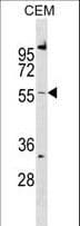 CALCRL / CGRP Receptor Antibody (aa340-367)