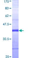 Human GUCY2C / Guanylyl Cyclase C Protein (Recombinant GST, N-terminus)