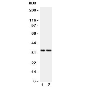 CD20 Antibody