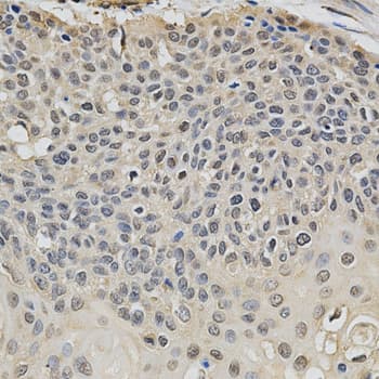 EIF4E Antibody