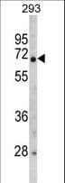 Polyclonal Rabbit anti-Human GNPAT / DHAP-AT Antibody (aa654-680, IHC, WB)