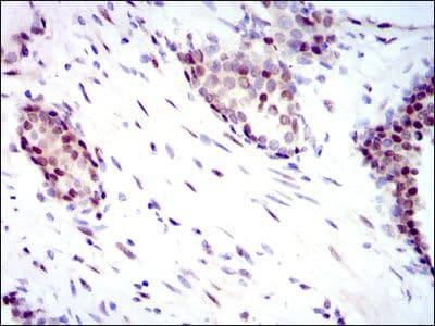 Monoclonal Mouse anti-Human YAP / YAP1 Antibody (clone 1A12, IHC, WB)