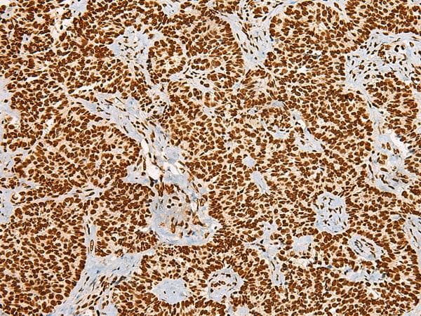 HABP4 Antibody