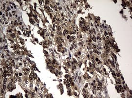 RASGRP3 / GRP3 Antibody (aa380-690, clone OTI2C9, Carrier-free)