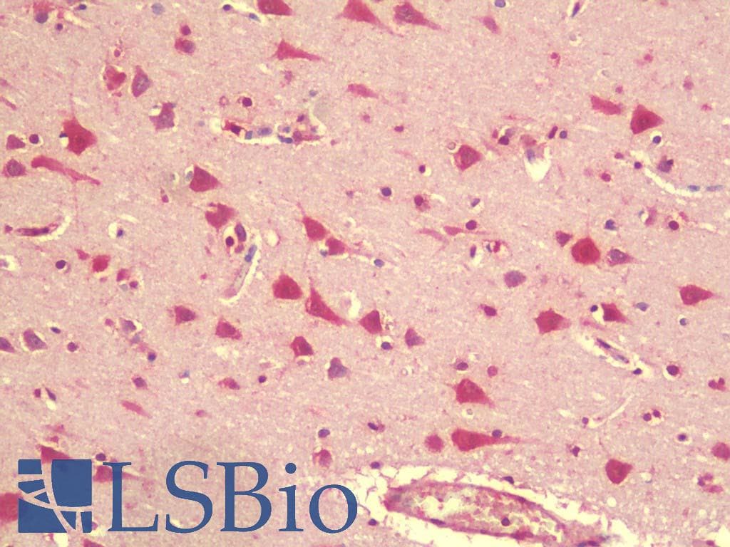 IHC-plus™ Polyclonal Rabbit anti-Human AFAP1 / AFAP Antibody (IHC, WB)
