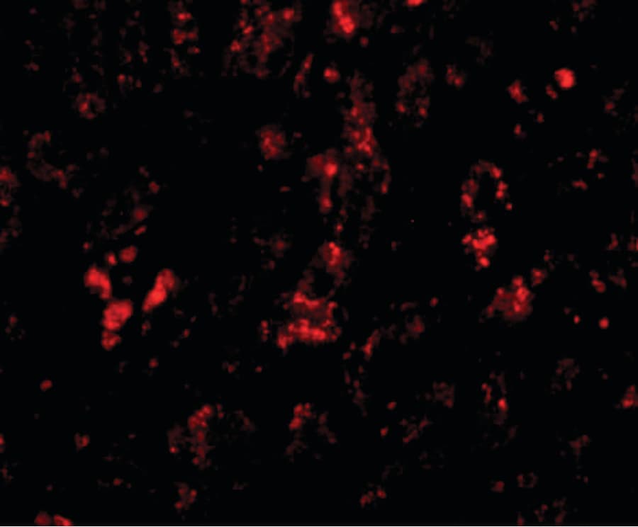 IHC-plus™ AFAP1L2 / XB130 Antibody