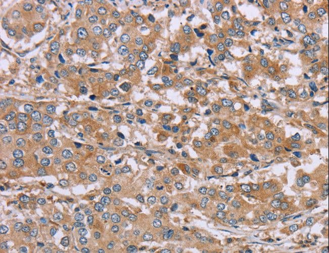 NDRG3 Antibody