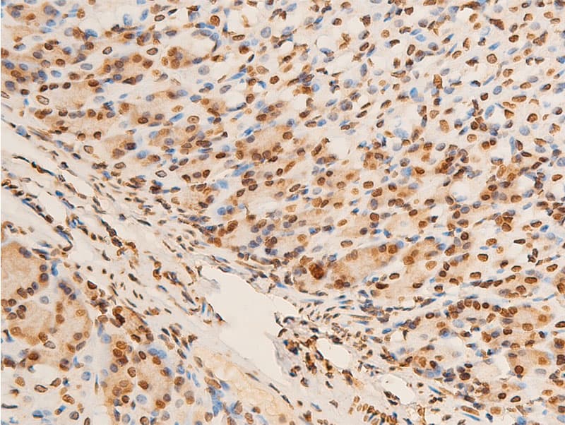 Polyclonal Rabbit anti-Human EIF2S1 Antibody (phospho-Ser51, IHC, IF, WB)