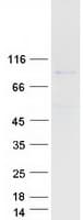 Human GYS1 / Glycogen Synthase Protein (Recombinant Myc-DDK (Flag))