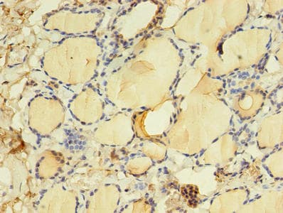 NR1A2 / THRB Antibody (aa1-461)