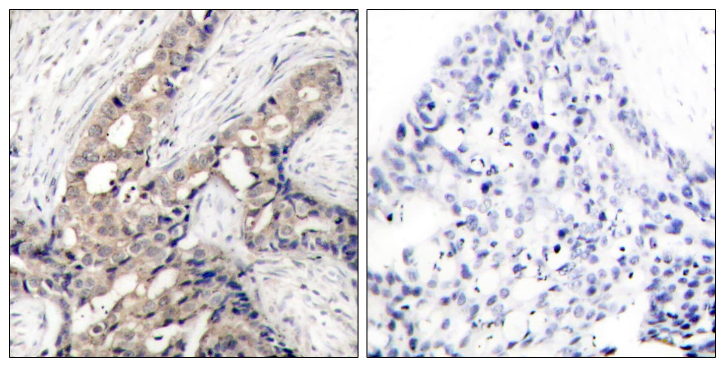 ABL Antibody (phospho-Tyr393)