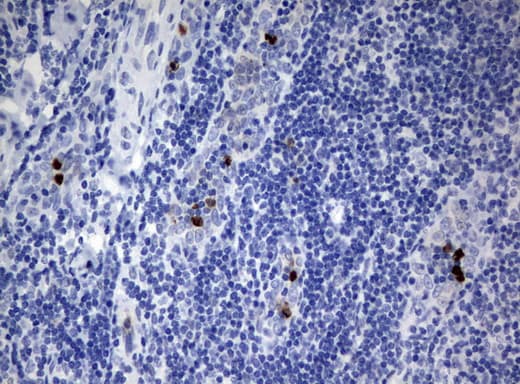 Monoclonal Mouse anti-Human PBX1 Antibody (clone UMAB111, IHC, IF)