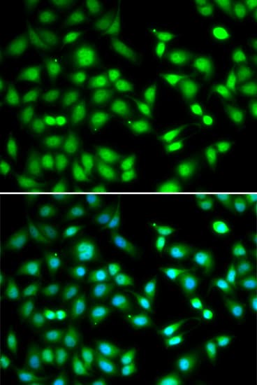 CDKN2D / p19 INK4d Antibody