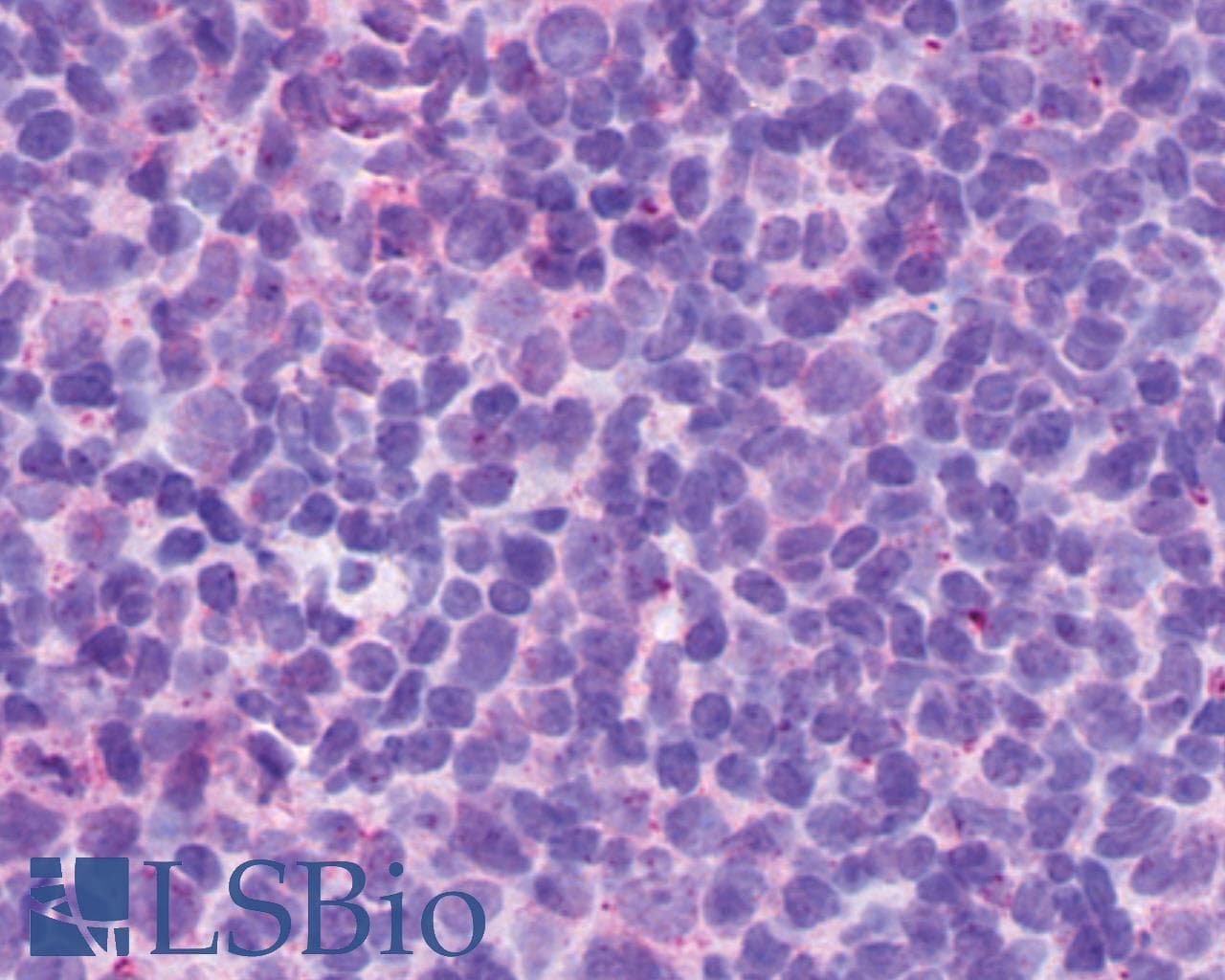 PathPlus™ P2Y13 / P2RY13 Antibody (Cytoplasmic Domain)