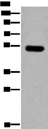 CDKL2 Antibody