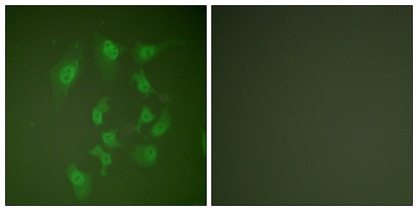 IHC-plus™ Polyclonal Rabbit anti-Human SMAD2 Antibody (aa418-467, IHC, IF, WB)