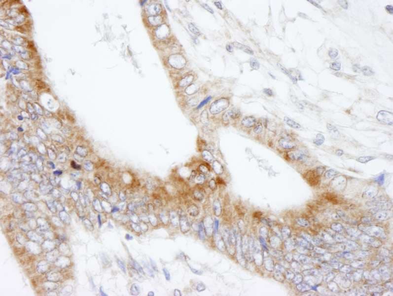 Polyclonal Rabbit anti-Human MAP7 Antibody (aa720-749, IHC)