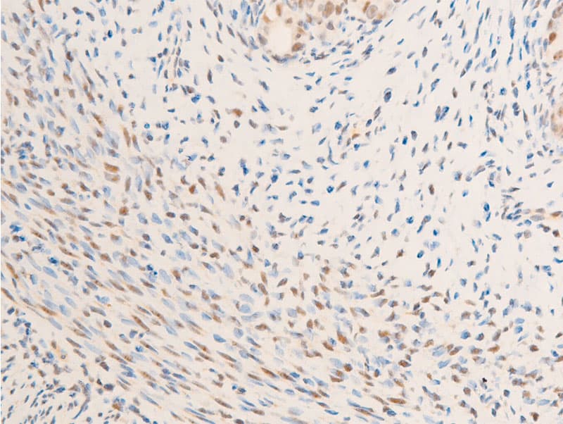NR3C1/Glucocorticoid Receptor Antibody (phospho-Ser203)