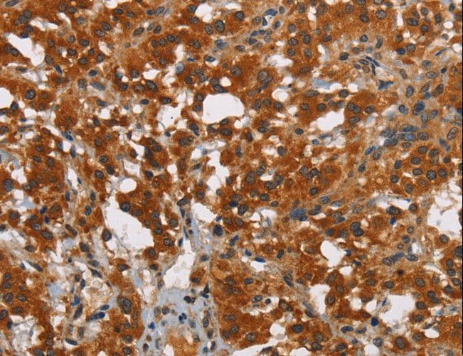 SMAD9 Antibody