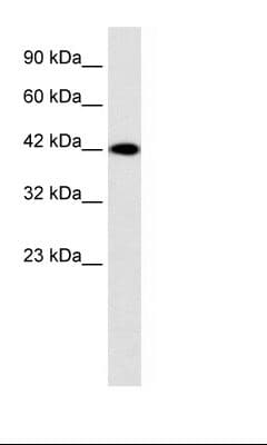 P2RX2 / P2X2 Antibody (aa35-84)