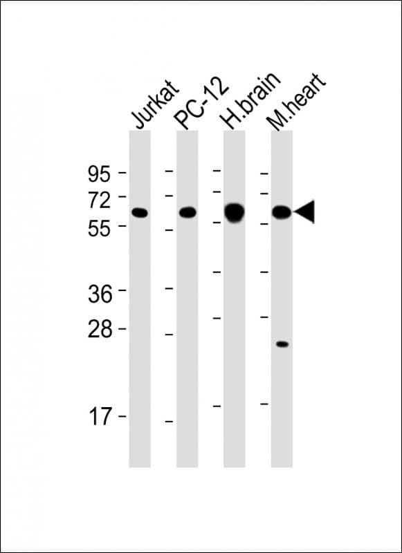 CAMK2B / CaMKII Beta Antibody (C-Terminus, clone 1050CT14.1.3)